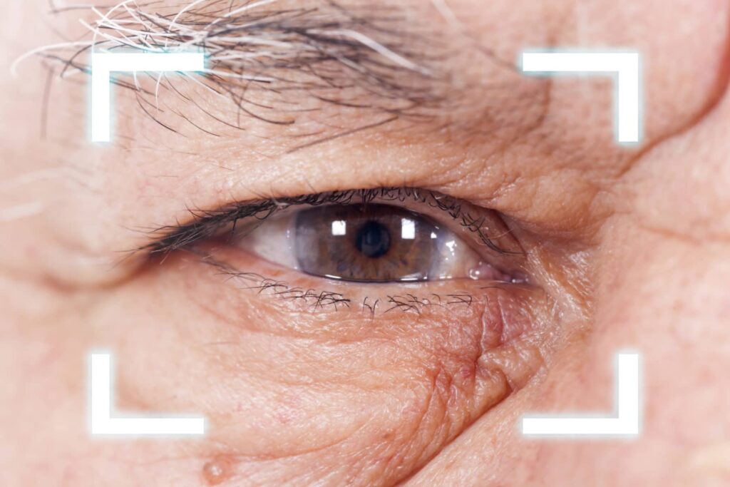 A Complete Guide to Cataracts Surgery: Types, Benefits, and Recovery